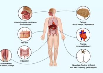 Lack of vitamin B12 – Causes and Treatment