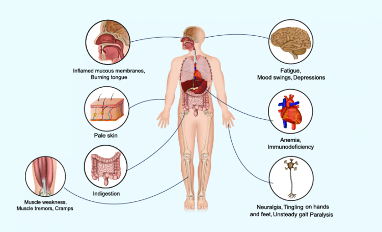 Lack of vitamin B12 – Causes and Treatment